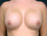 Patient # 45696 After Photo # 2